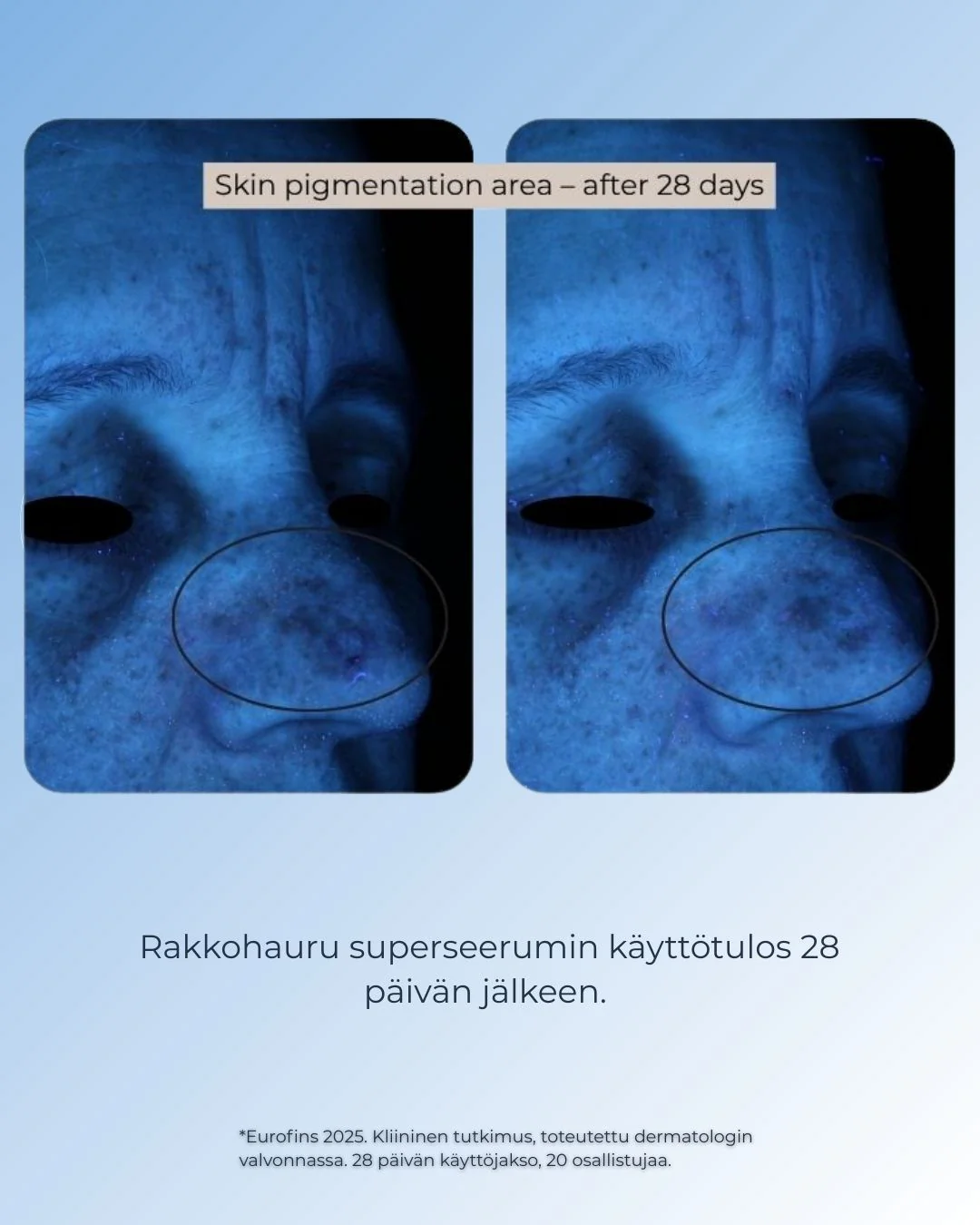 Tuotekuva 10