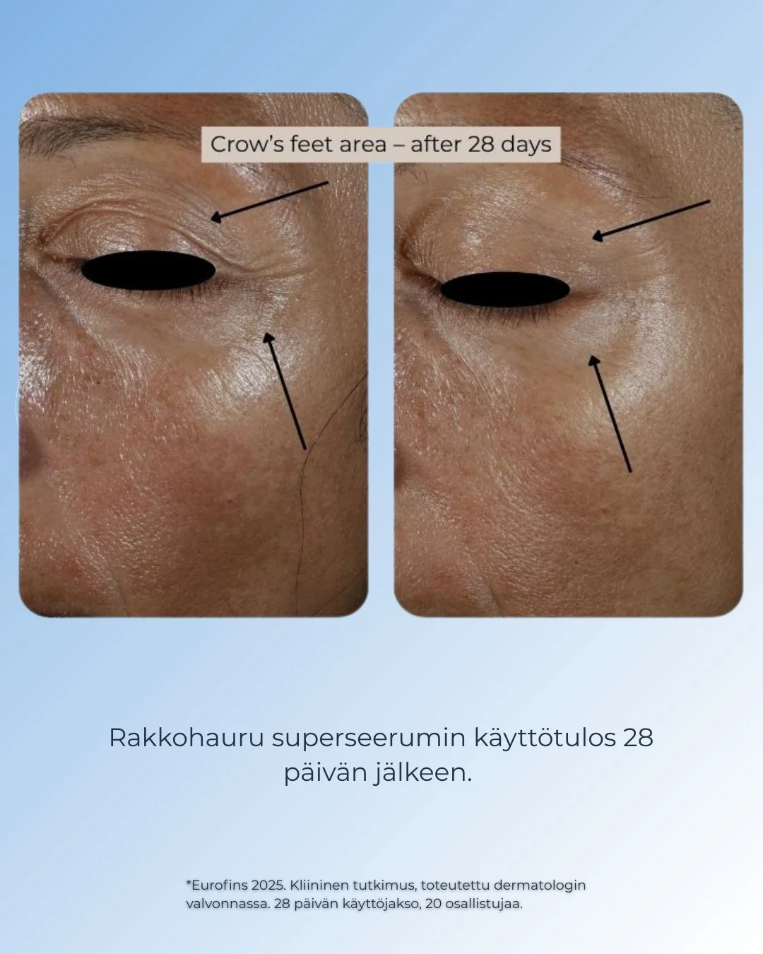 Tuotekuva 6
