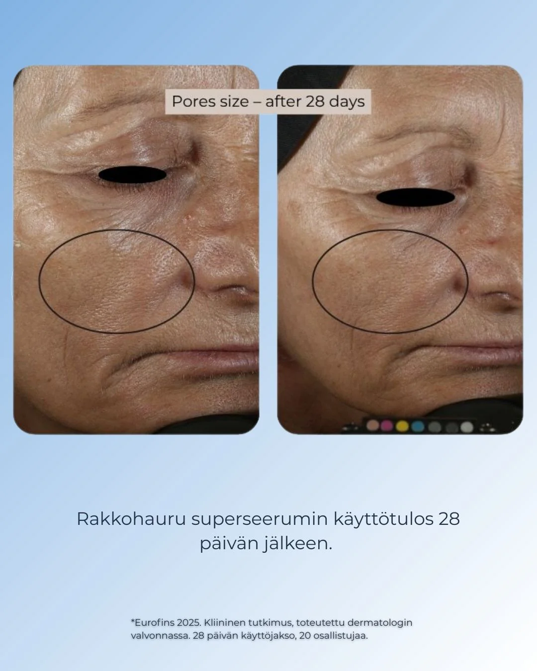 Tuotekuva 8