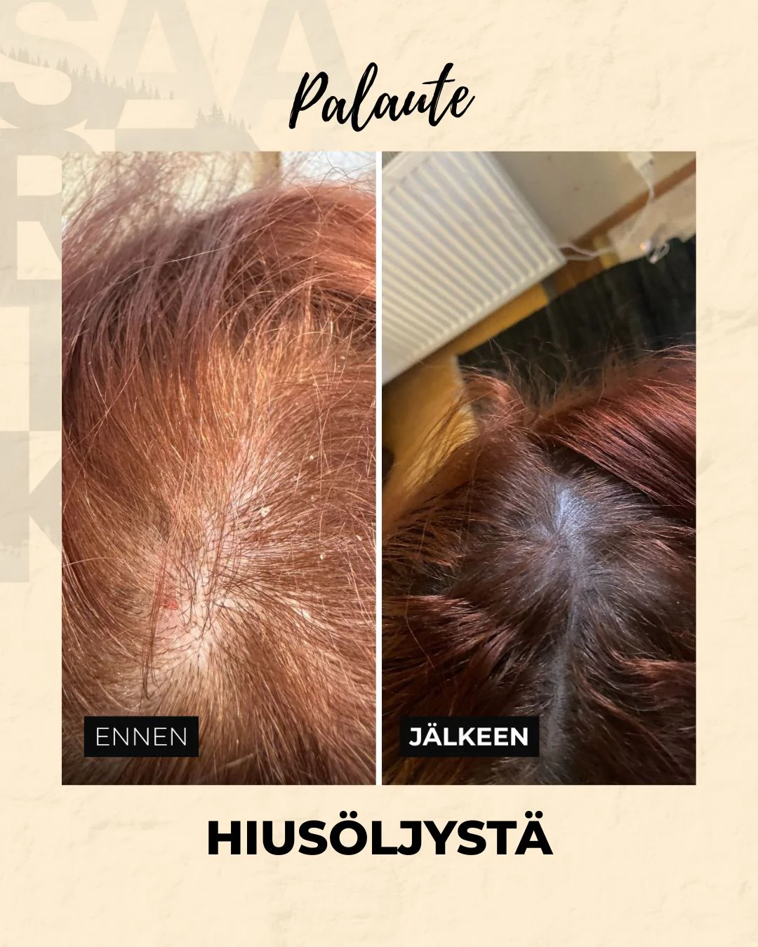 Tuotekuva 8