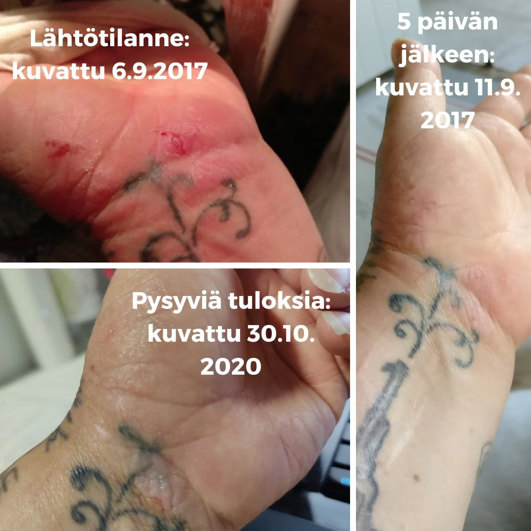 Tuotekuva 3