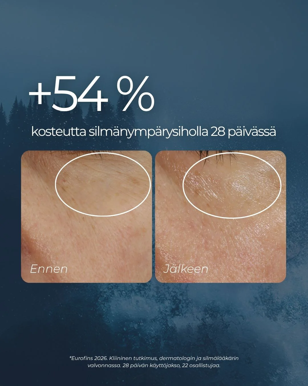 Tuotekuva 7