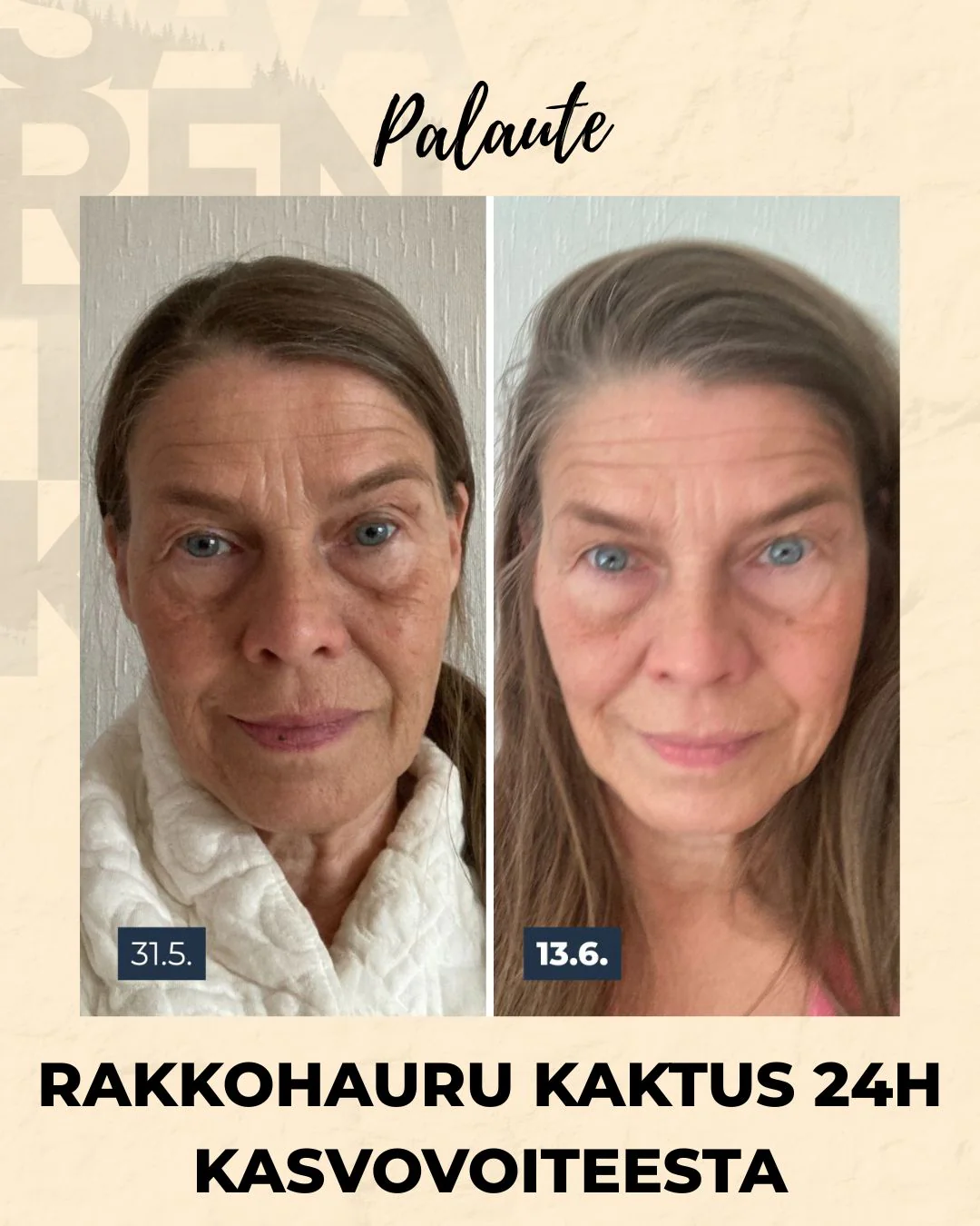 Tuotekuva 14
