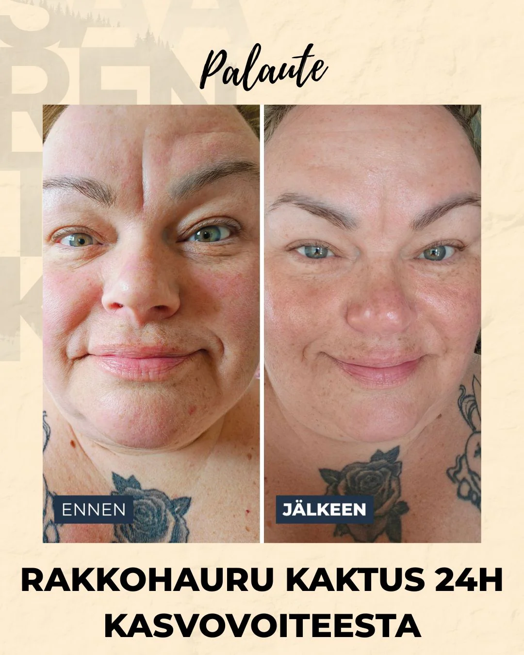 Tuotekuva 15