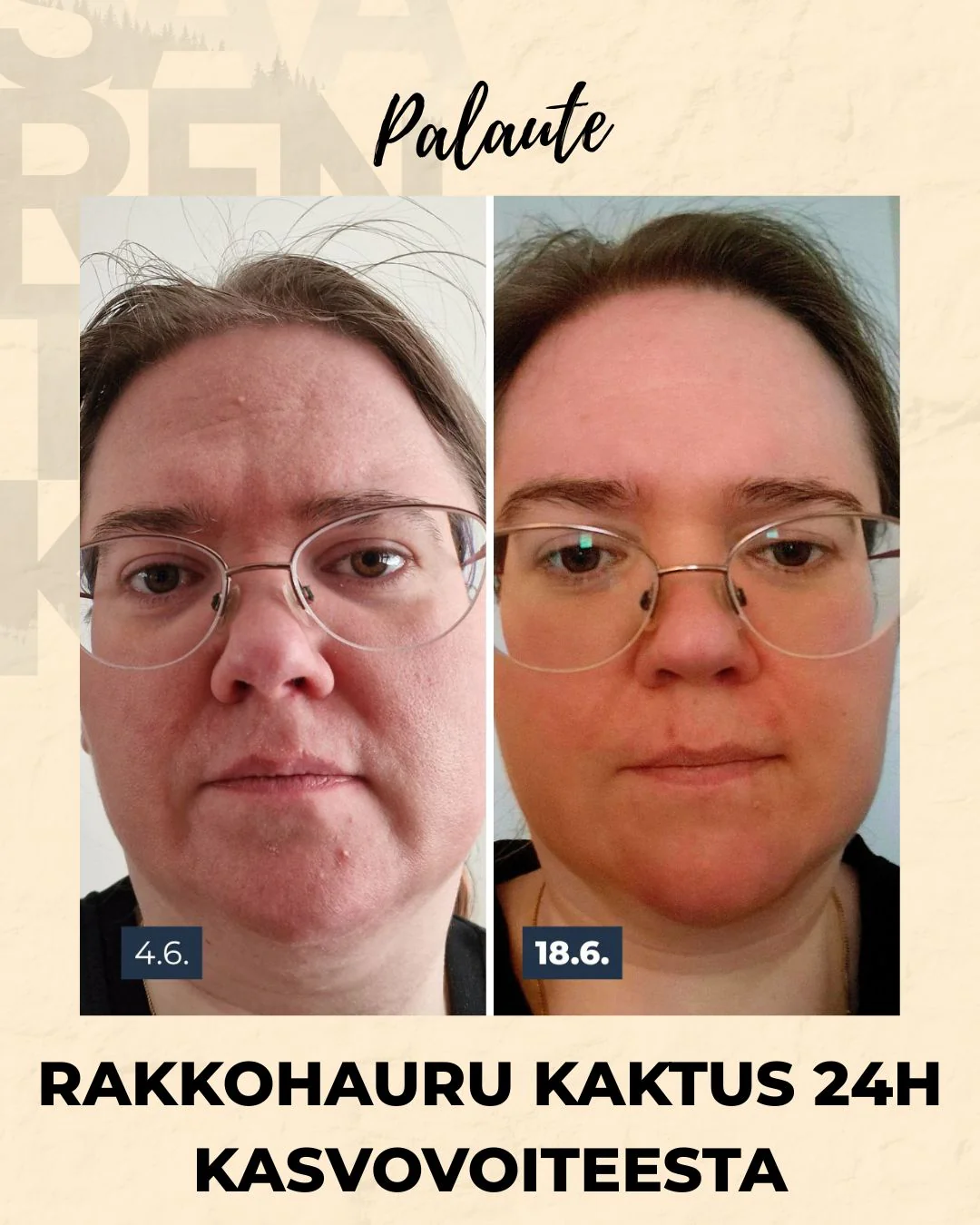 Tuotekuva 16
