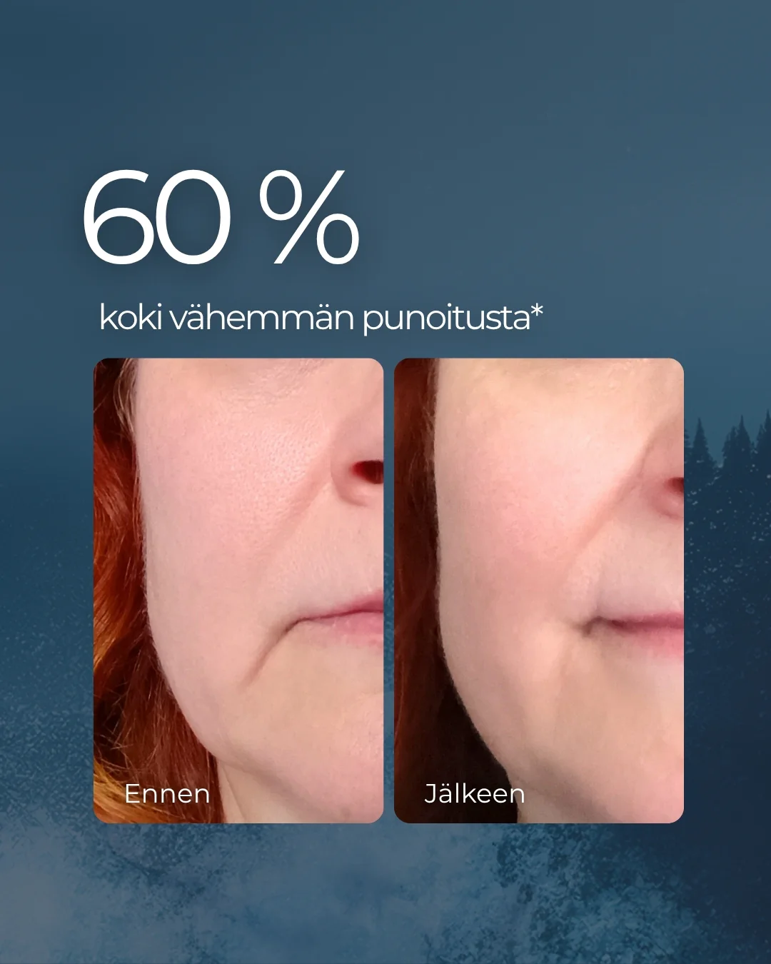Tuotekuva 4