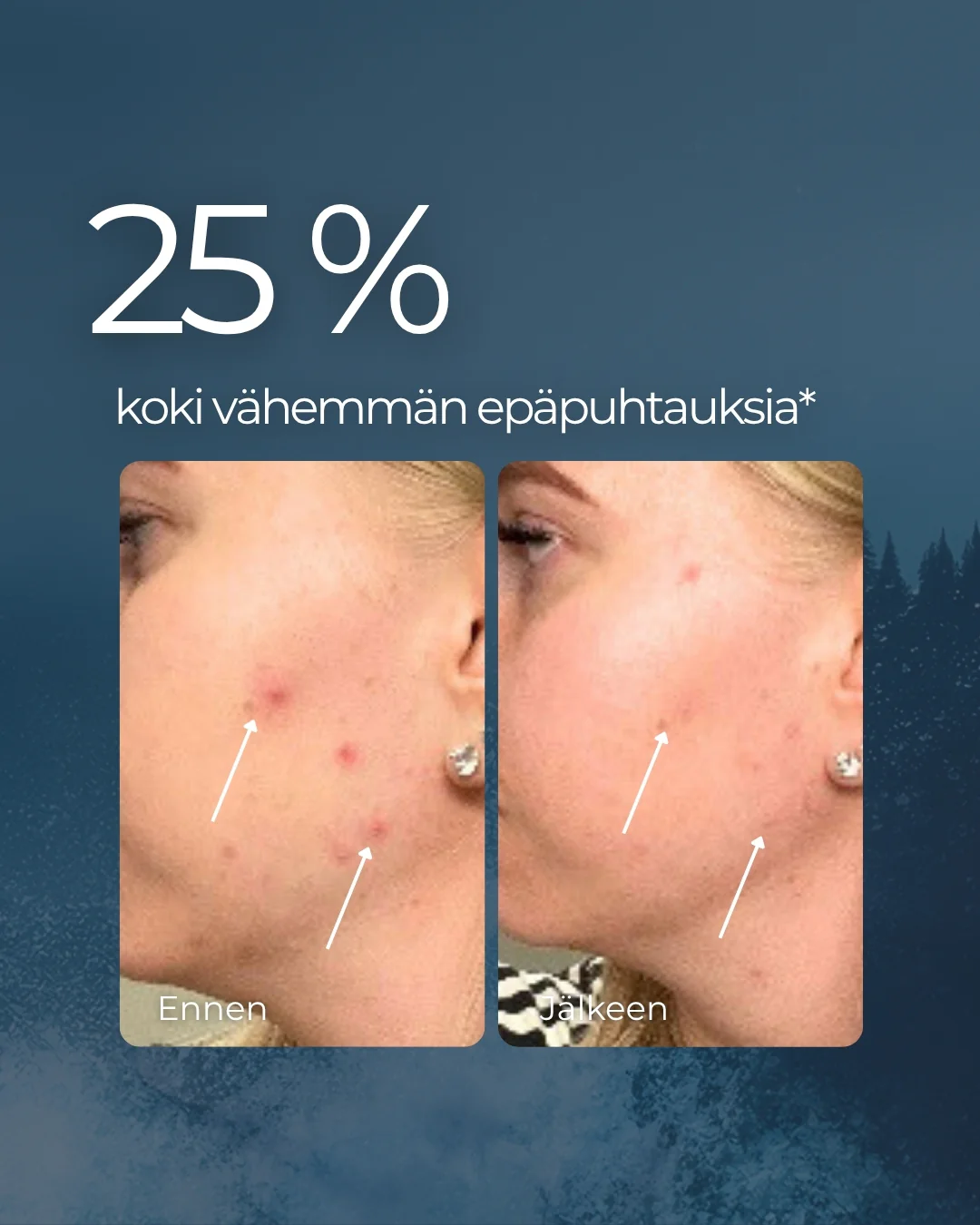 Tuotekuva 5