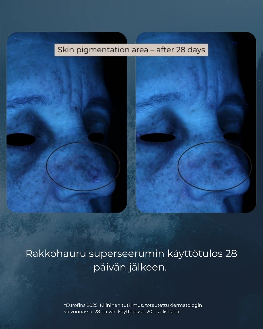 Tuotekuva 10