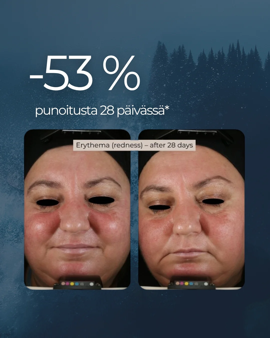 Tuotekuva 5