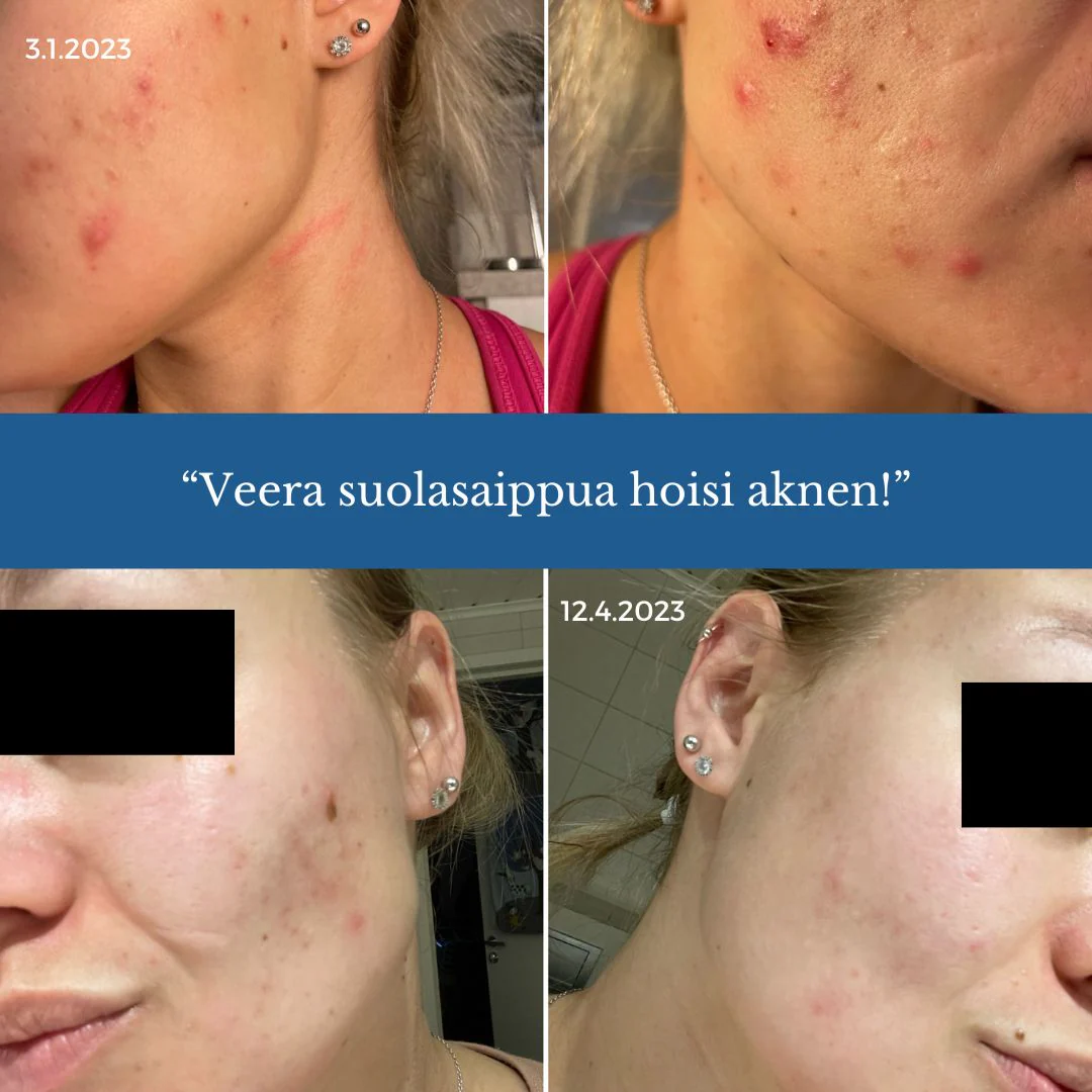 Tuotekuva 3