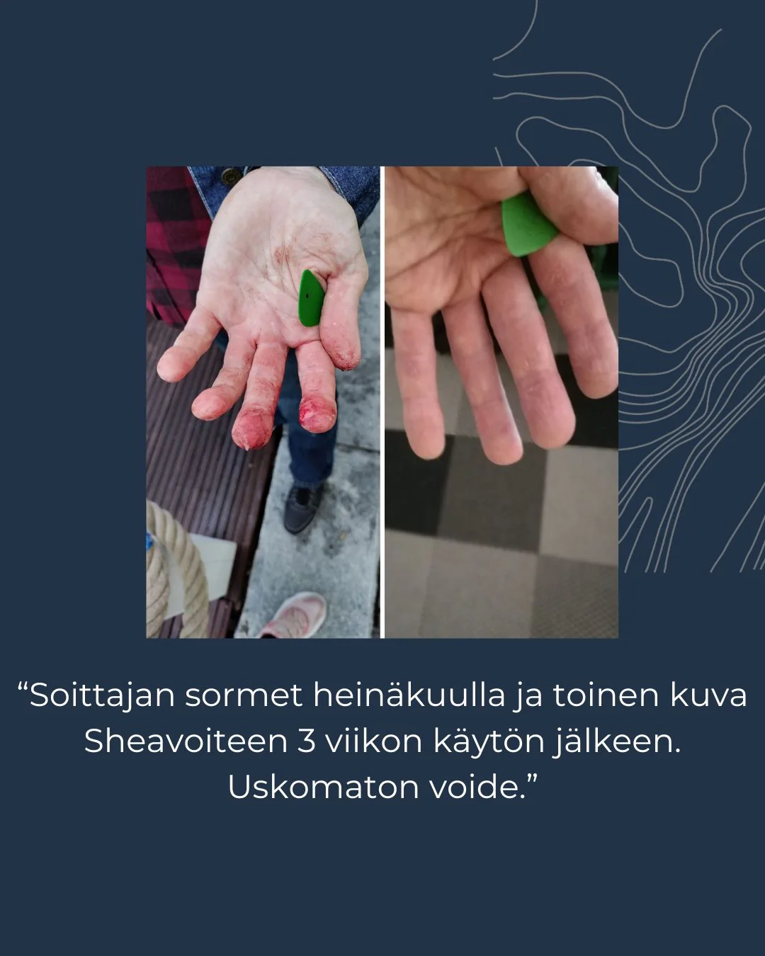 Tuotekuva 4